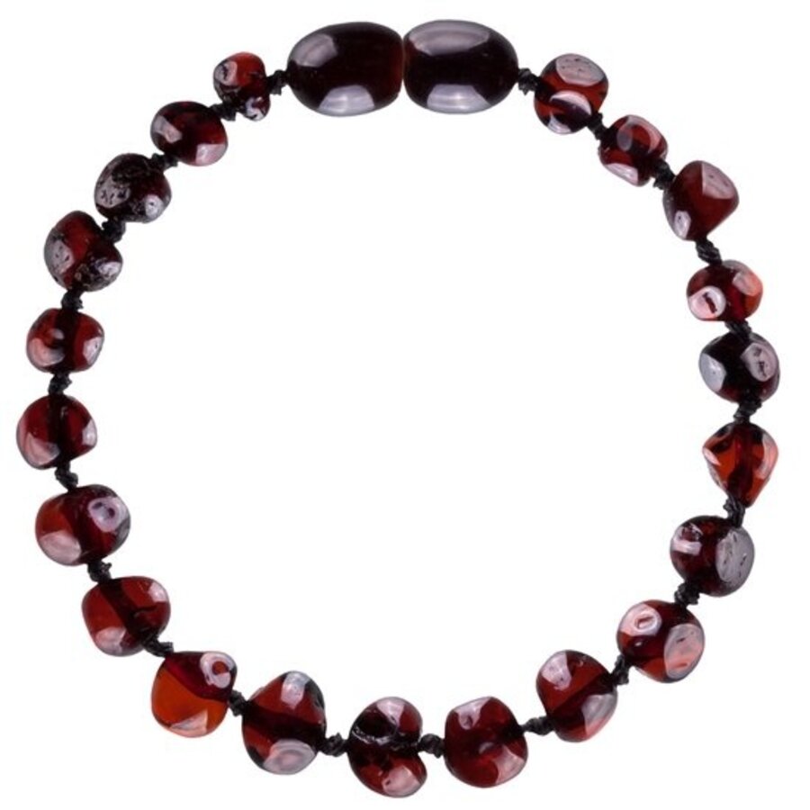 Wild Sun Barnsteen Armband Volwassene - Amber Enkelbandje Kind - Baltische Barnsteen – 19 cm - Cherry