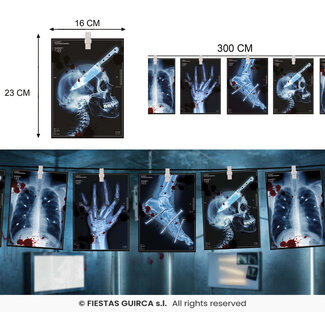 Guirca Radiografische Slinger - 3mtr. papier - 16x22 cm