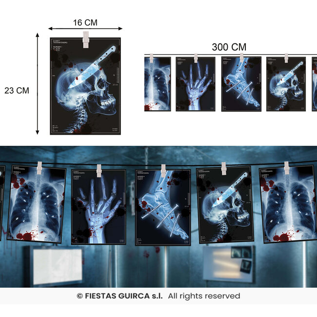Radiografische Slinger - 3mtr. papier - 16x22 cm