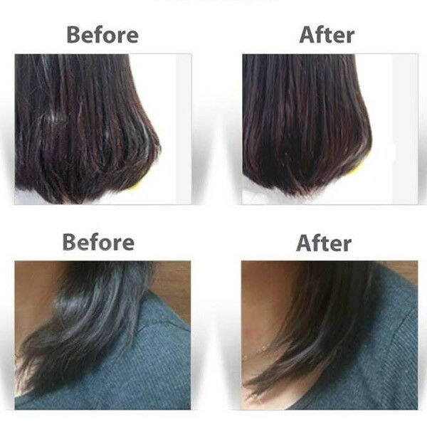 Parkjuns Electric Home Hair Care Treatment Cap Thermal Steamer