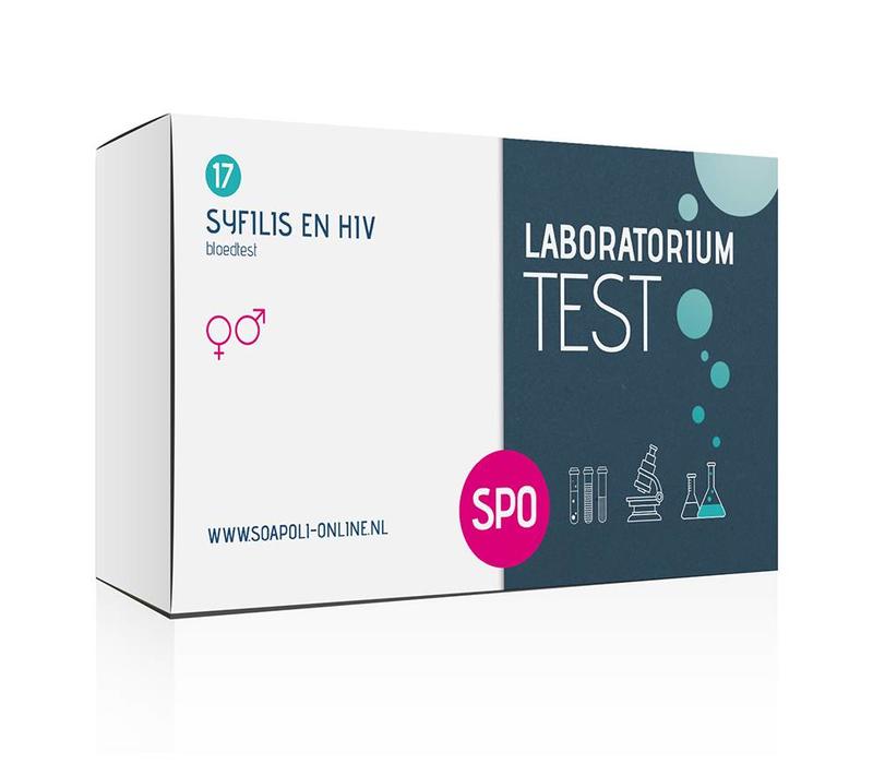 Syfilis en HIV test - professionele laboratorium test