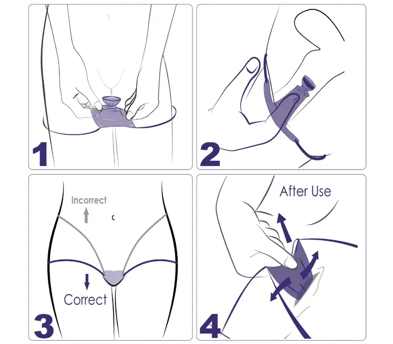 Vrouwencondoom met beenbandjes