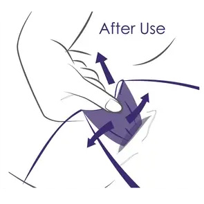 vrouwencondoom verwijderen