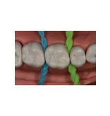 iDontix Professionals X-Floss 12 x 30 unidades