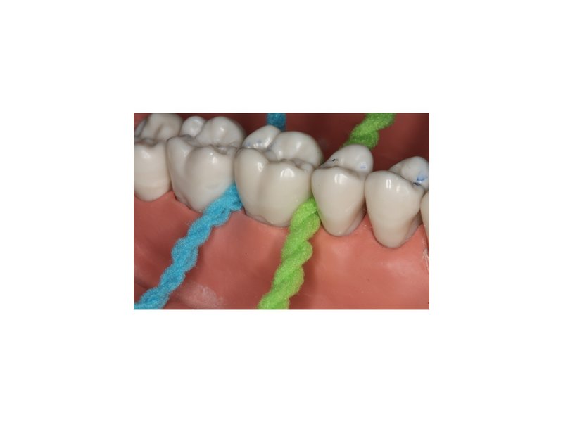 iDontix Professionals X-floss lite 12 x 30unidades