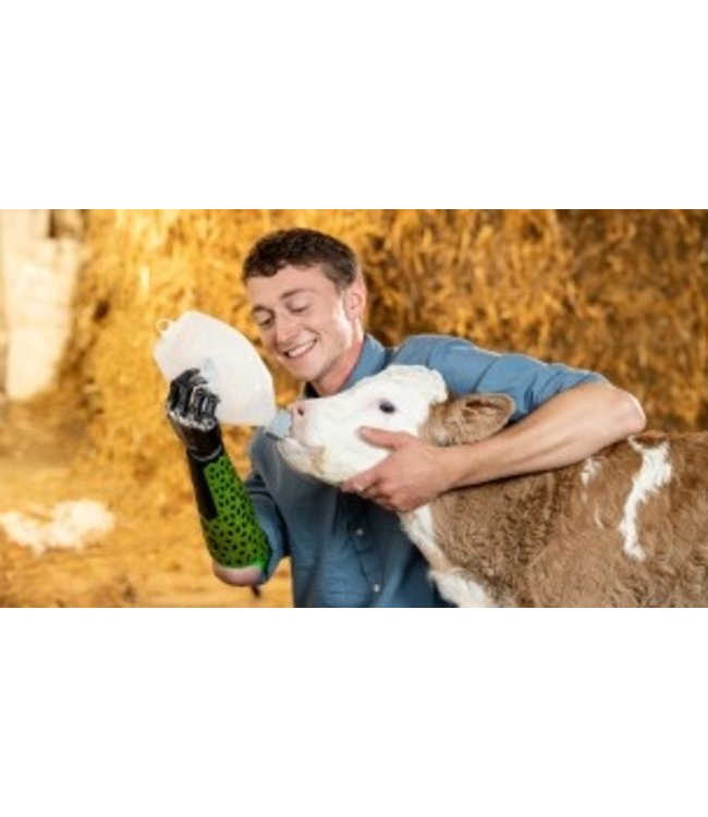 Otto Bock Bebionic Myo Elektrische handprothese