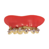 Teeth Braces Thermoplastic