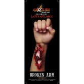 Applicatie - Broken Arm / gebroken arm