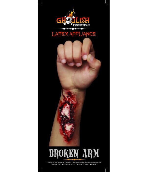 Applicatie - Broken Arm / gebroken arm
