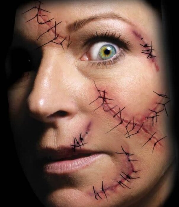 Trauma Tattoos stitched / genaaide wonden