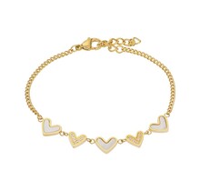 iXXXi Armband Lover