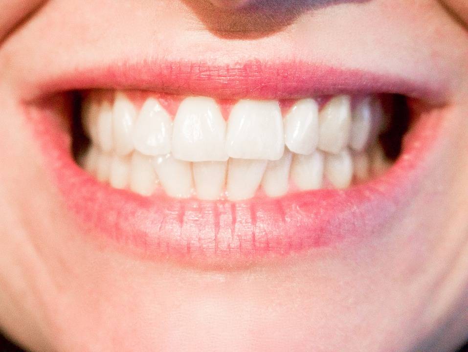 Augment Wonderbaarlijk Boekhouding Tanden bleken met natuurlijke tandpasta voor mooie witte tanden - Improve  Your Health