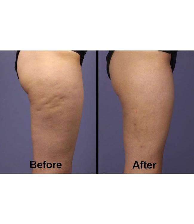 Wonder Patch Been Pleisters