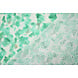 Bordado Inglés Algodón Tie Dye Verde Mar Bordado Inglés Algodón Tie Dye Verde Mar