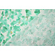 Ricamo Cotone Tie-Dye Verde Mare Ricamo Cotone Tie-Dye Verde Mare