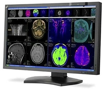 NEC NEC MD302C4 29.8 "4k Monitor con retroiluminación LED de pantalla ancha con pantalla médica