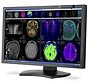 NEC MD302C4 29.8 "4k Medical Display Widescreen LED-Backlight Monitor