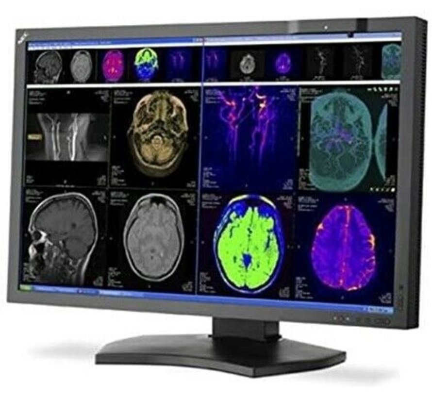 NEC MD302C4 29.8 "4k Monitor con retroiluminación LED de pantalla ancha con pantalla médica