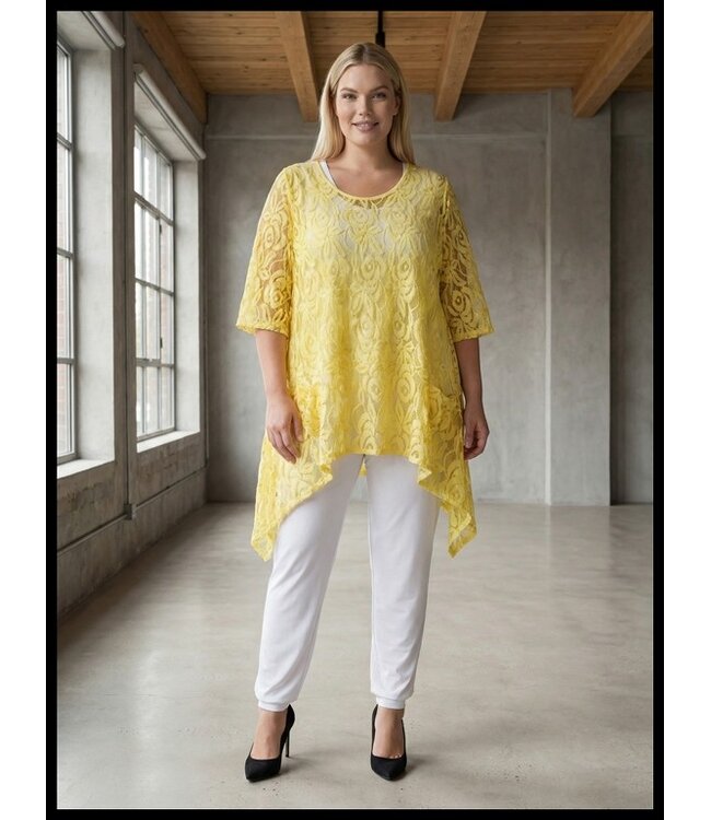 Yellow Moonshine Tunic