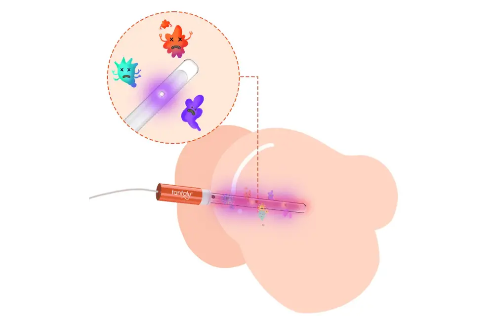 Tantaly UV-sterilisator Verwarmingsstaaf – Veilig & Snel