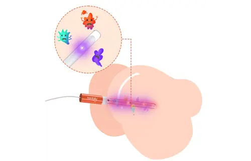Tantaly UV-sterilisierender Heizstab