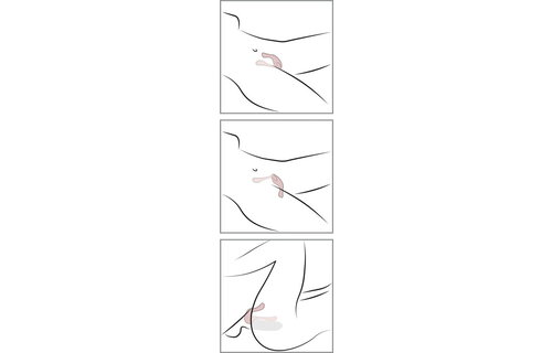 Lovers Koppel Vibrator - Dubbele Stimulatie & 10 Vibratiestanden