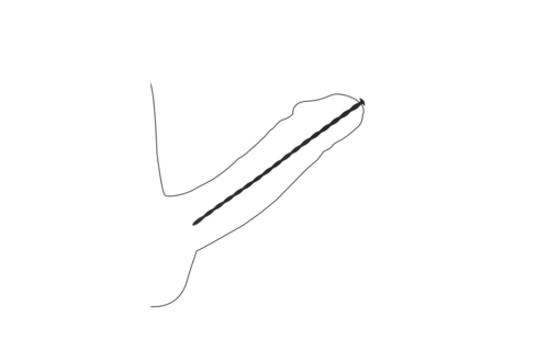 Siliconen Spiraalschroef Plug Set Beginners