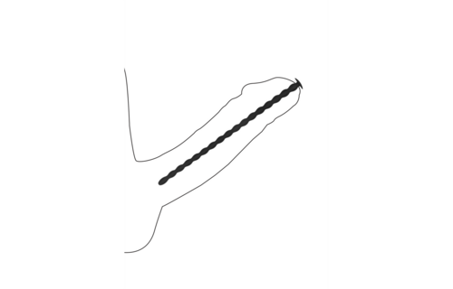 Silicone Spiral Screw Plug Set Advanced | Safe Urethral Pleasure