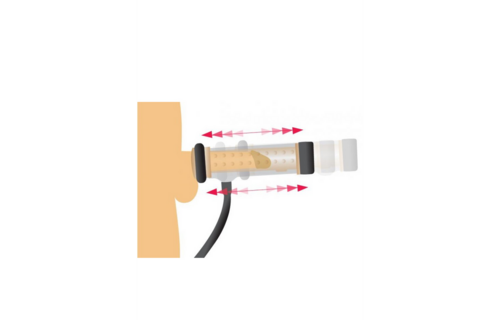 Textured Melker Cilinder