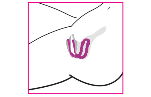 Petal Pusher Silicone Labia Spreader – Ultimate Pleasure