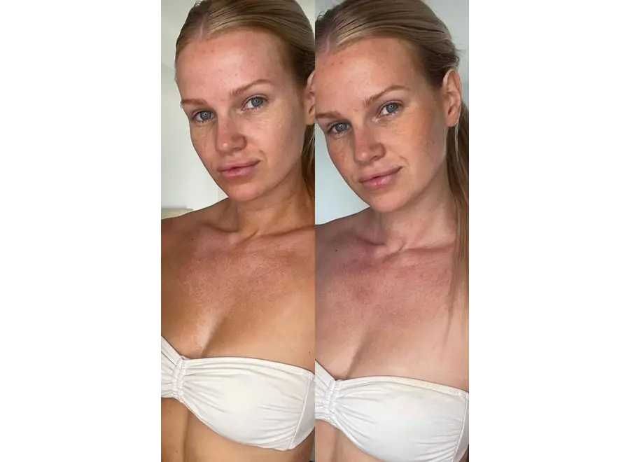 Vani-T Ultimate Bronze Set - Medium