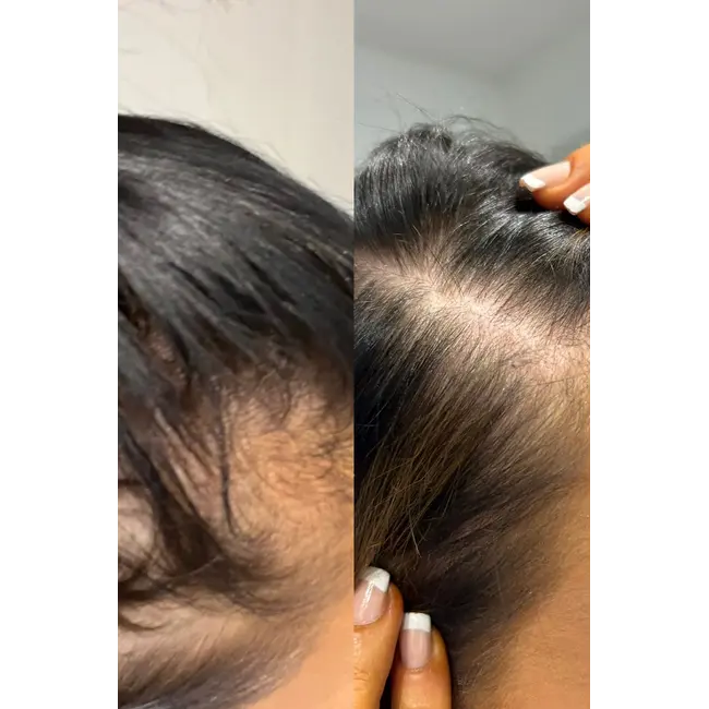 Gloss Hair Growth Shampoo & Conditioner Duo - Minis