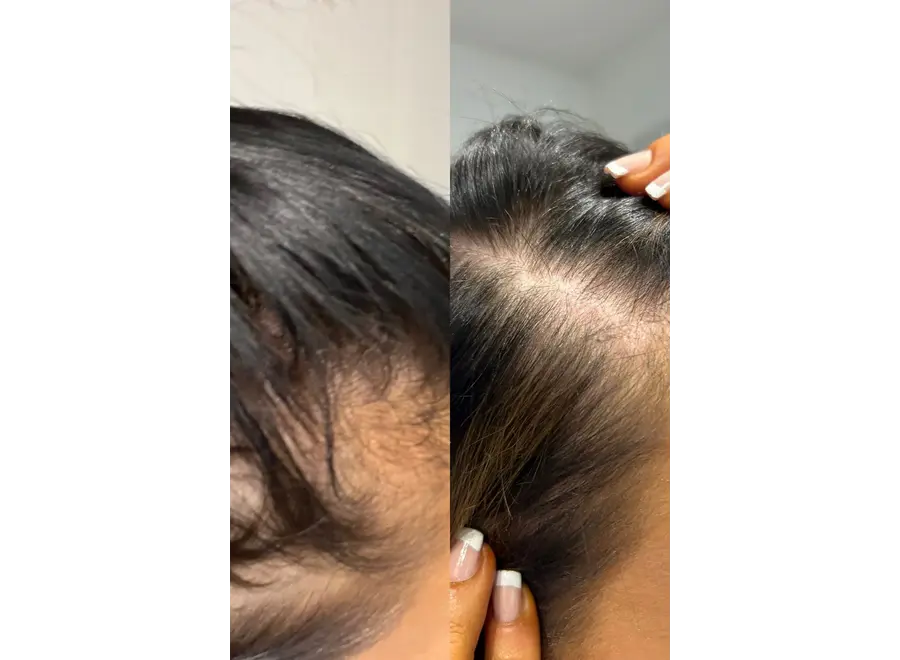 Vani-T Gloss Hair Growth Shampoo & Conditioner Duo - Minis