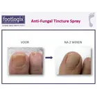 Nail Tincture Spray