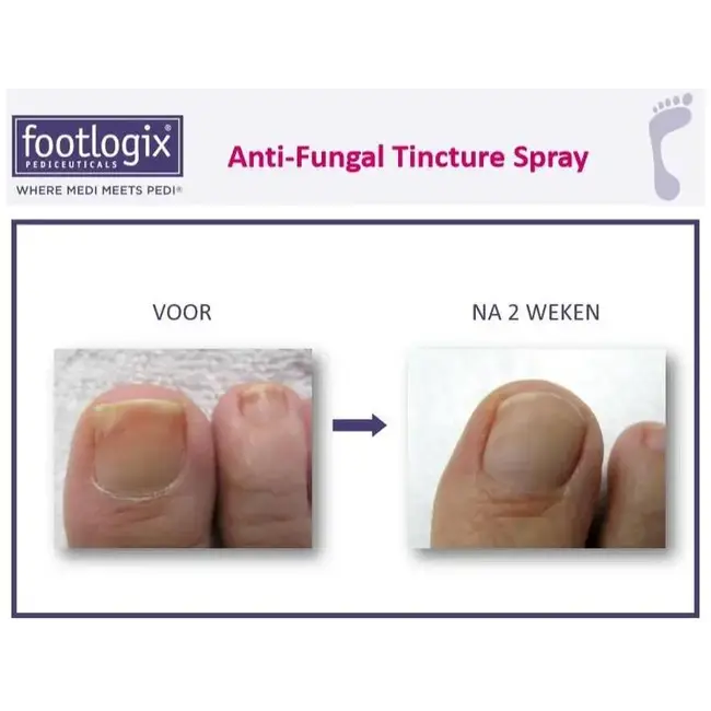 Nail Tincture Spray