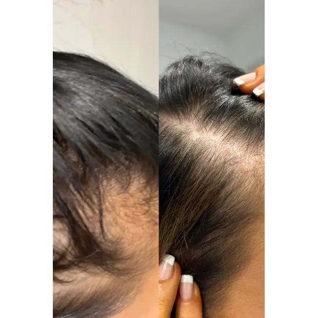 Gloss Hair Growth Conditioner met GHK-Cu Copper Peptides