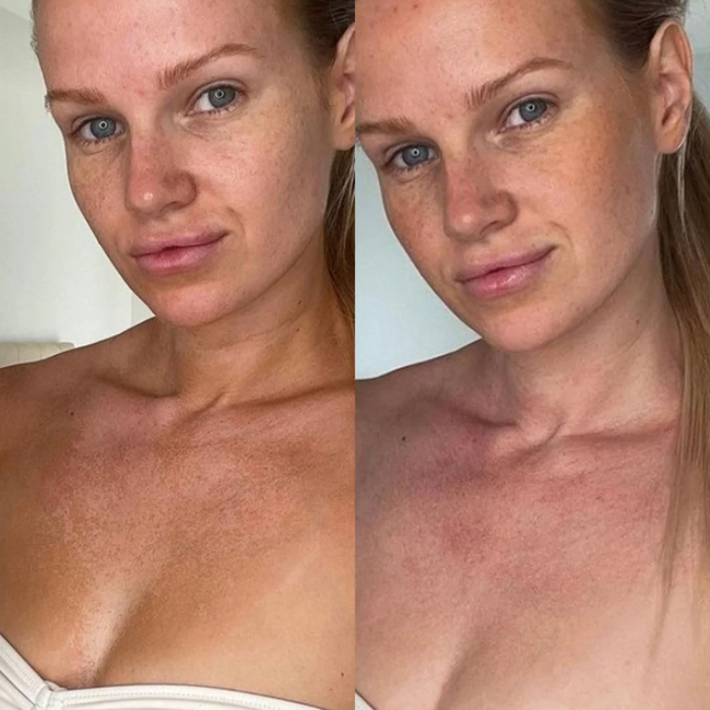 Tan Eraser - Tan Removal Mousse