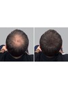 Hair Building Donkerbruin Fibres, 25 gram