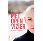 Met open vizier