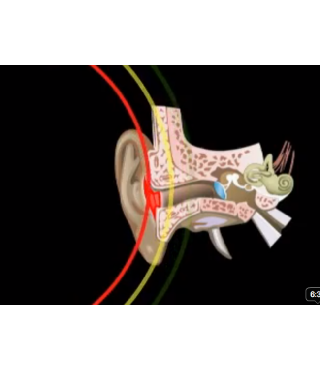 DOC's ProPlugs oordoppen