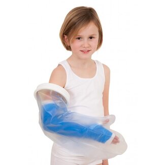 Able 2 Gipshoes hele arm kind 1 Stuks