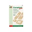 Sensitive wondpleister mix 20 Stuks