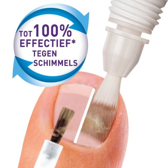 Mycosan Traitement et camouflage des mycoses de l'ongle 1 Set