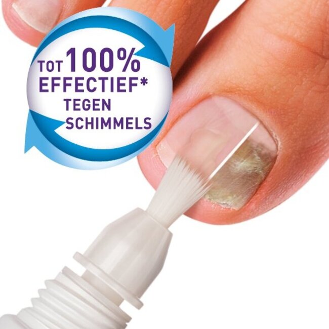 Kit de traitement contre les mycoses des ongles 5 ml