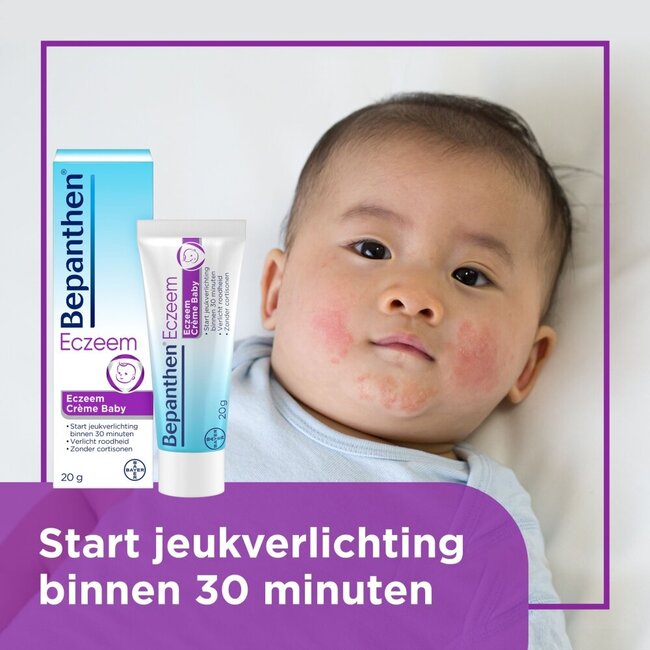 Eczema baby cream 20g