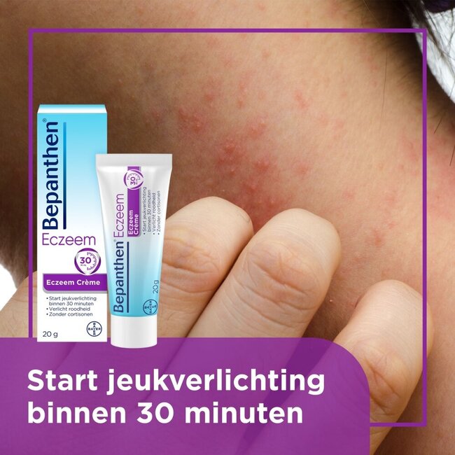 Crema per Eczema 20 Grammi