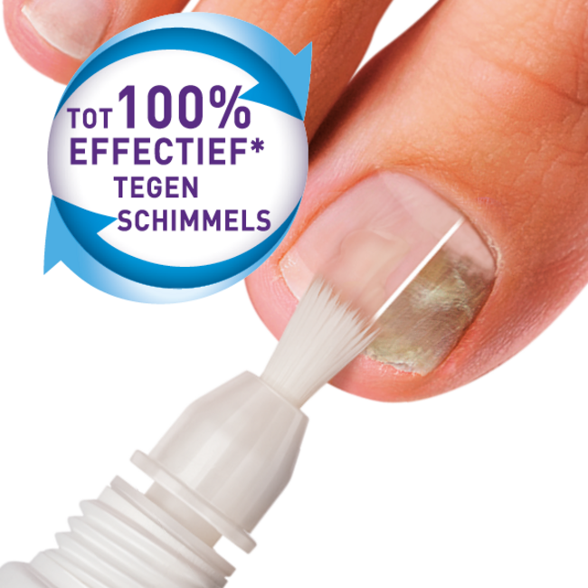 Kalknagel Behandlungsset XL 10 Milliliter