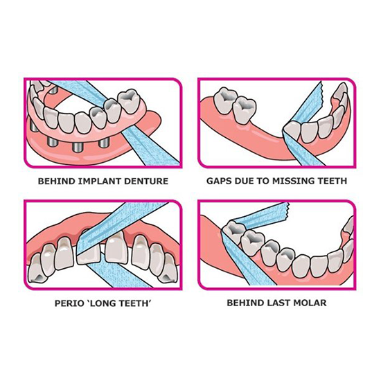 iDontix X-Ribbon | 12 meter