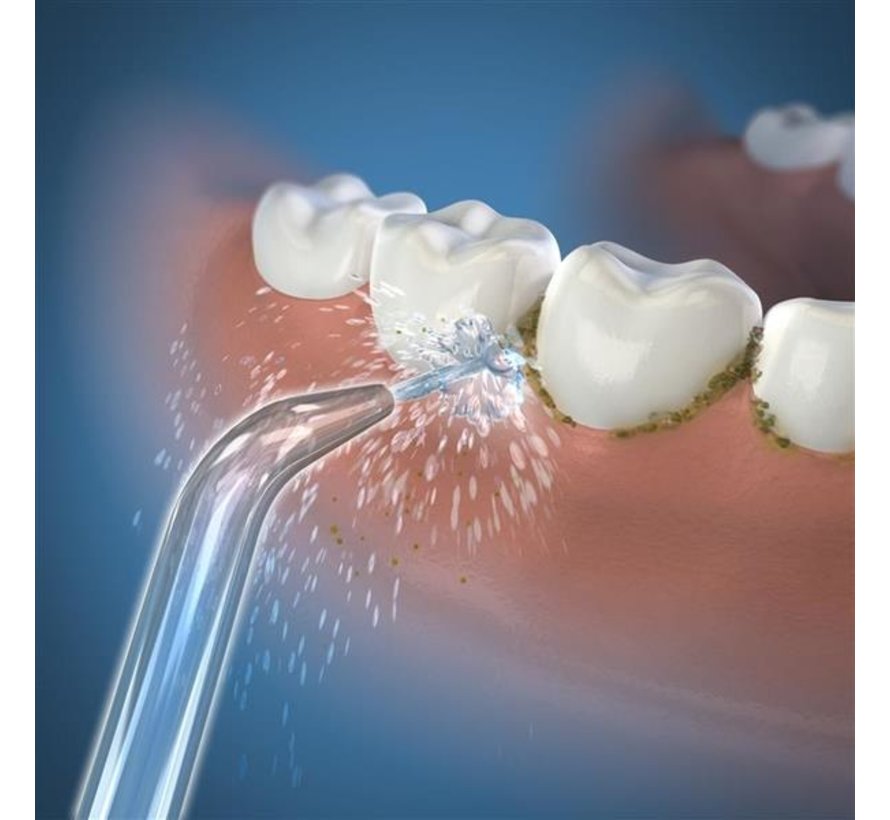 Waterpik Classic HighPressure Jet Tips JT450E 2x Kiesrijk