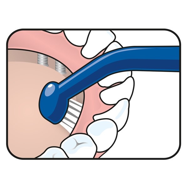 TePe Implant Care - 3 stuks - Tandenborstel (universal care)